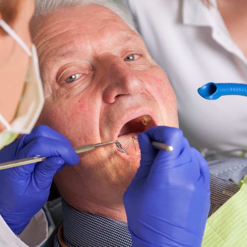 man having gum cleaned periodontics