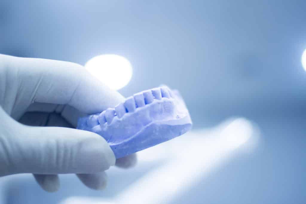 purple dental mould after orthodontic consultation SpaDental